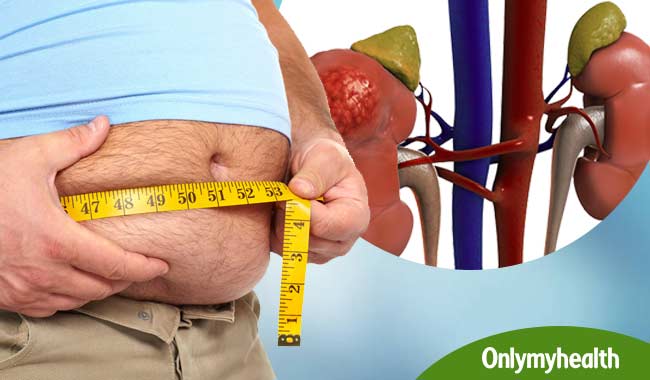 मोटापा है किडनी फेल्योर का सबसे बड़ा कारण, शुरुआत में ही दिखते हैं ये लक्षण